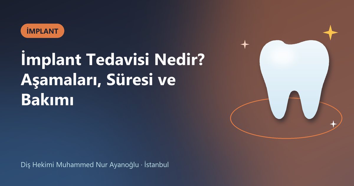 İmplant Tedavisi Nedir? Aşamaları, Süresi ve Bakımı – Dt. Muhammed Nur Ayanoğlu blog kapak görseli